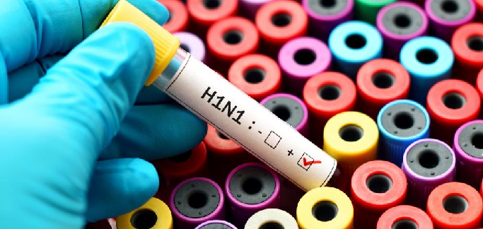 O exame de H1N1 que os planos de saúde são obrigados a cobrir não dá resultado na hora | Foto: Divulgação